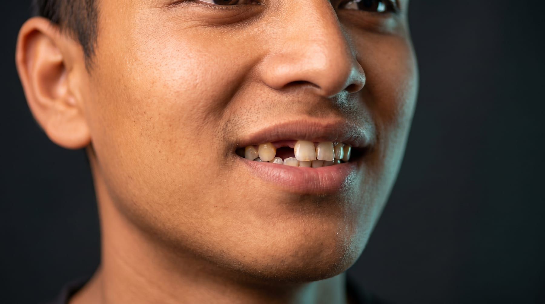 Before: Dental implant