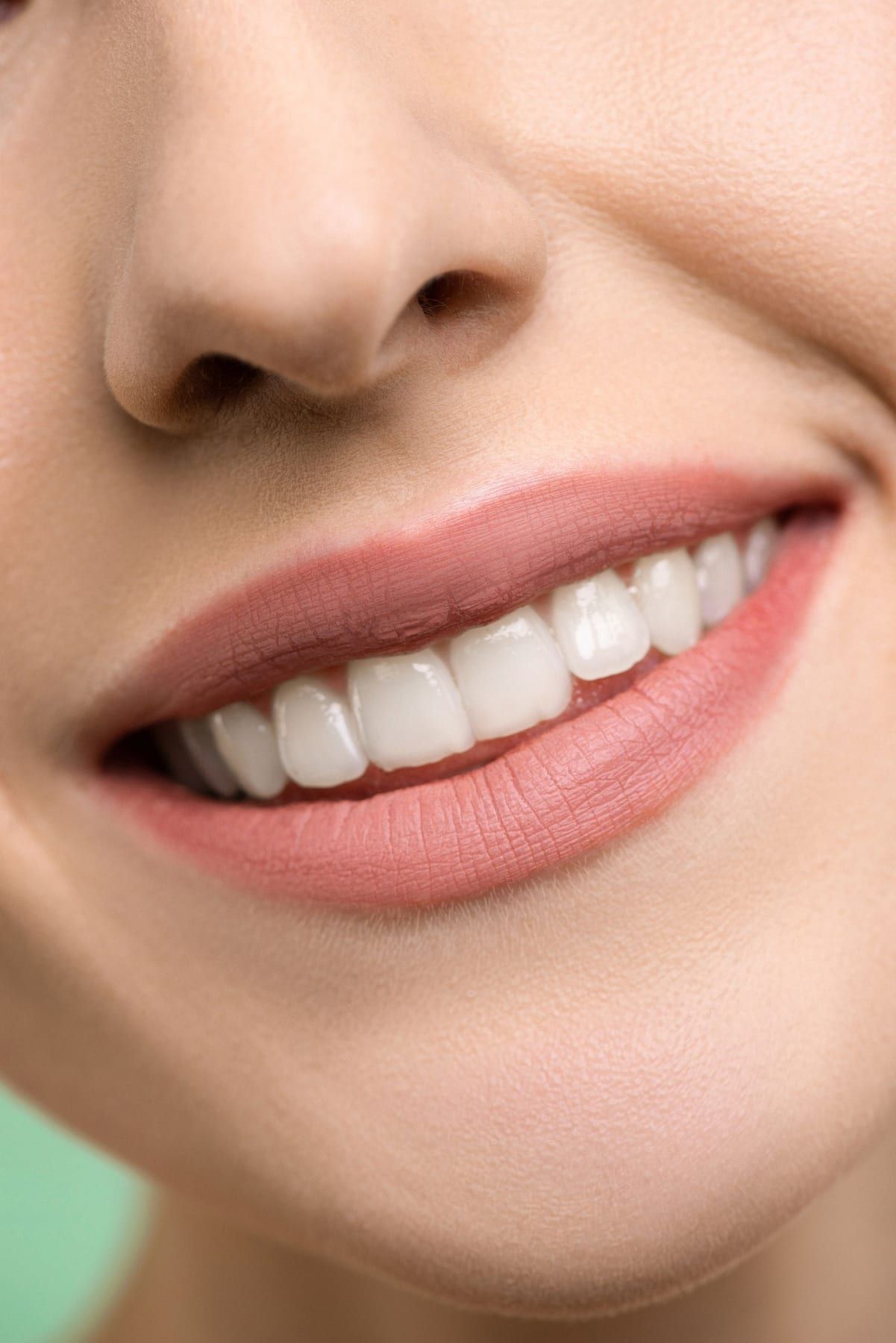 After: Clear aligners