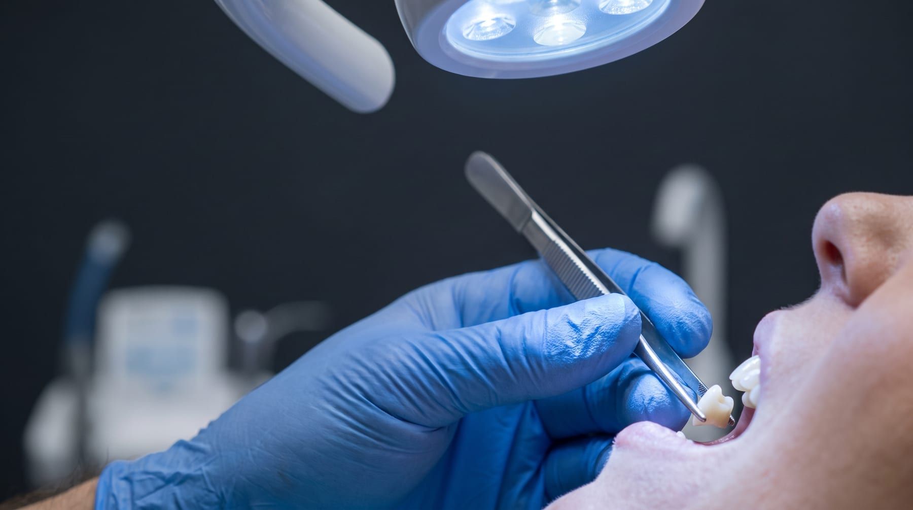Restorative Dentistry at Ujyalo Dental